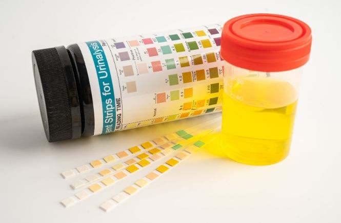 Diagnostics